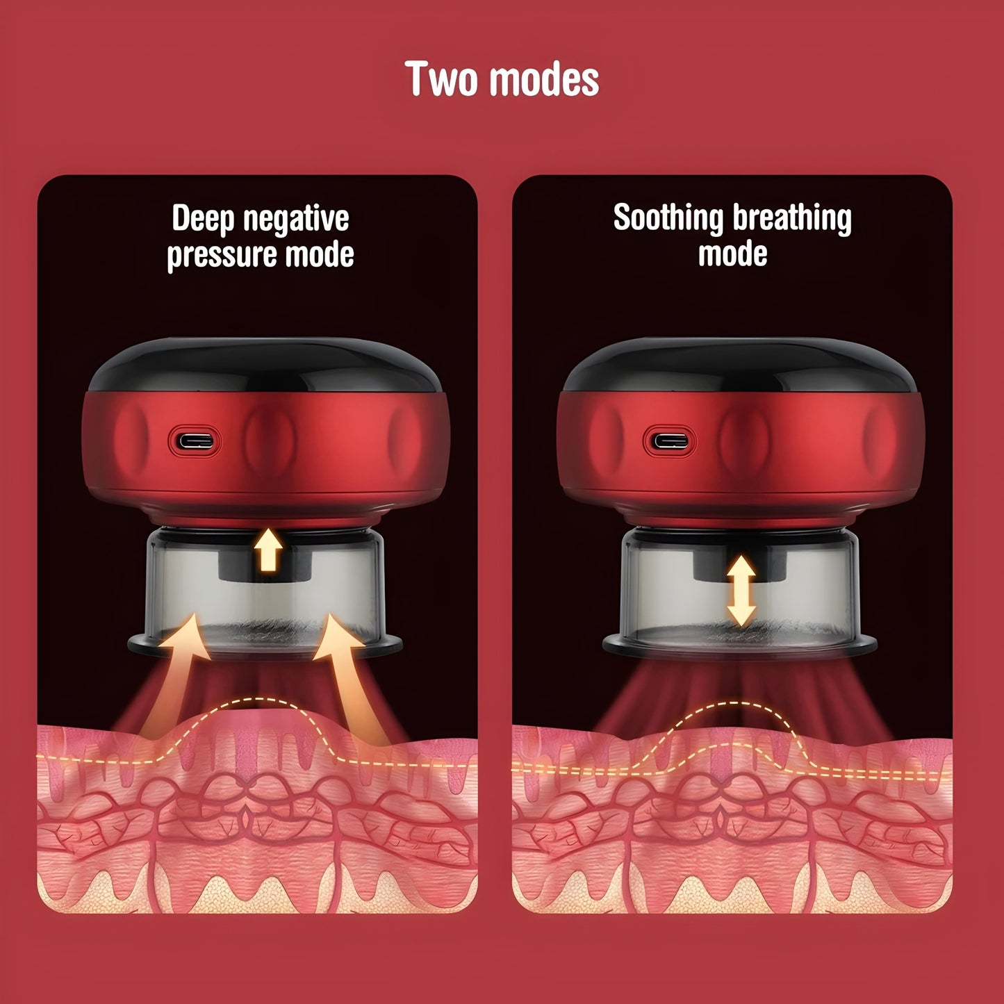 Cupping massage device with adjustable suction and heat for home use